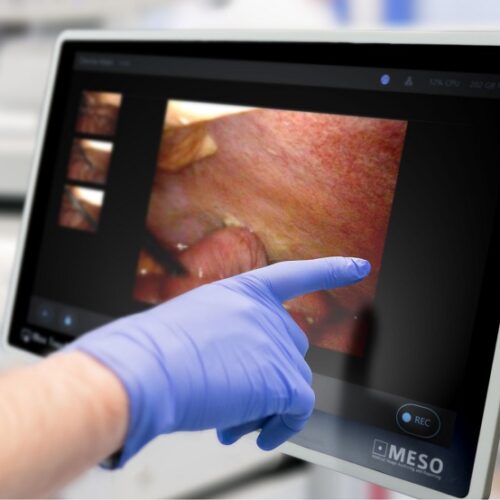 Dispositivo IBox Touch para el envío de imagen médica en HCE y PACS