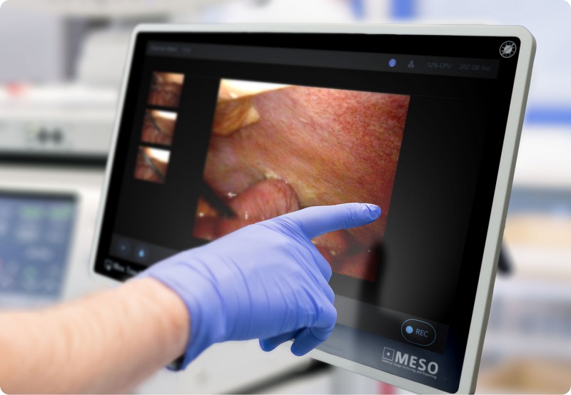 Dispositivo IBox Touch para el envío de imagen médica en HCE y PACS
