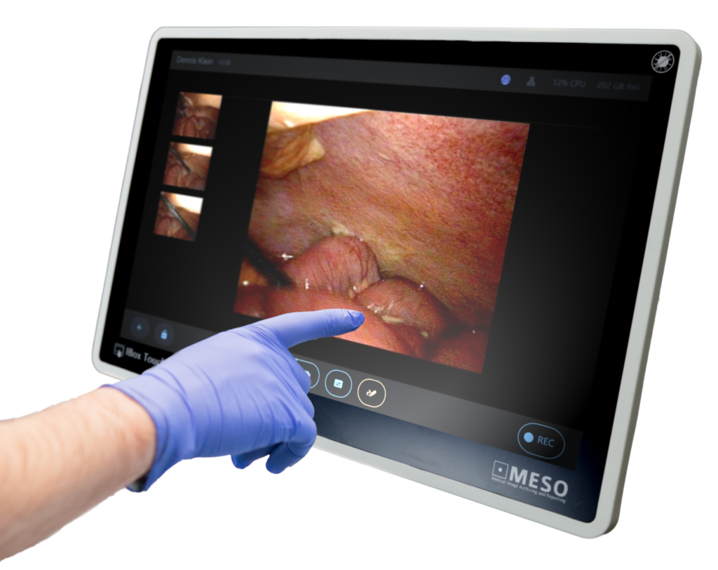 Panel de control y herramientas de edición de imagen médica en iBox MESO.